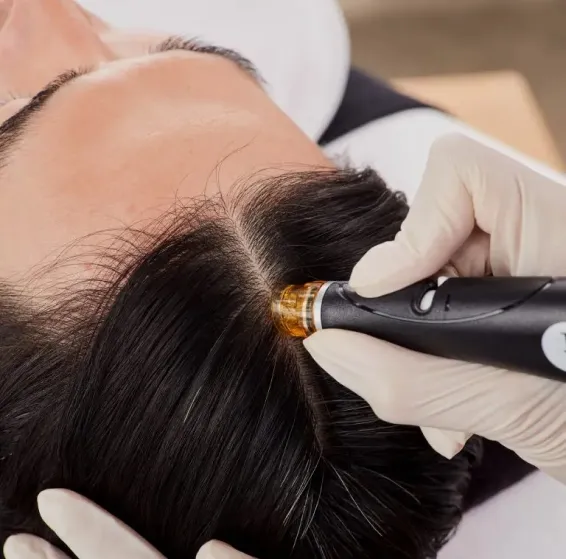 HydraFacial Keravive scalp treatment Scarborough
